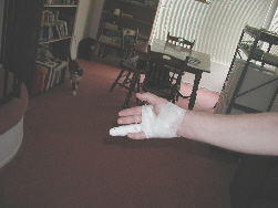hand in bandage